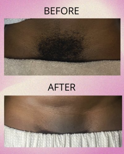 Before and after waxing service results
