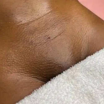 Smooth skin after a bikini wax